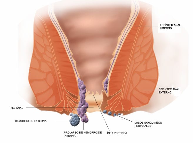 La levadura hace mal a los intestinos